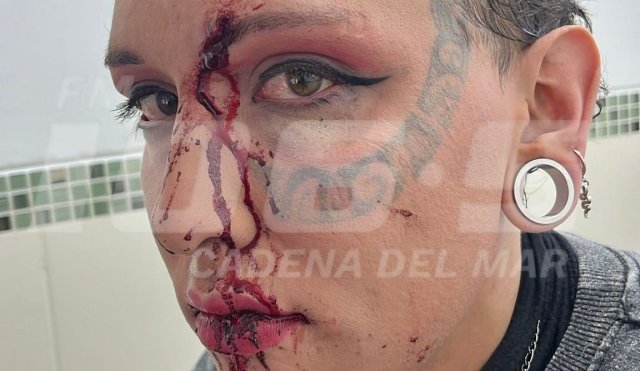 Chica trans golpeada en Piriápolis 1