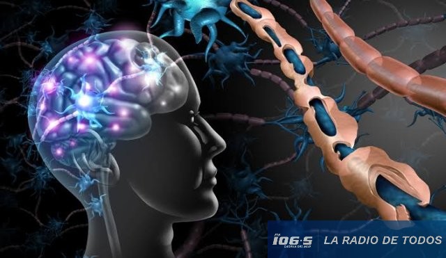 ESCLEROSIS MULTIPLE 25.12