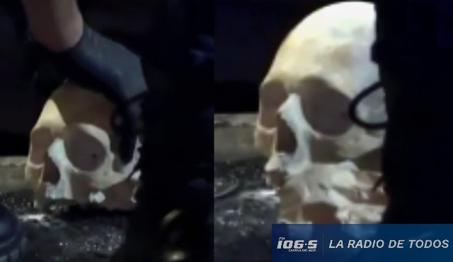 Hallazgo Macabro (Montevideo): cráneo humano apareció en contenedor.